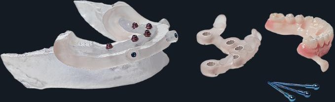 Full arch system layout
