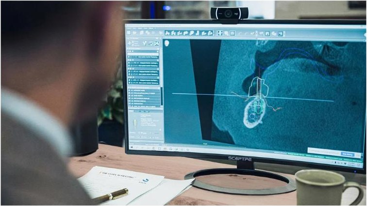 Guided surgery planning