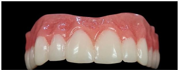 Digital dentures