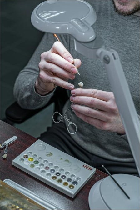 Custom restorations